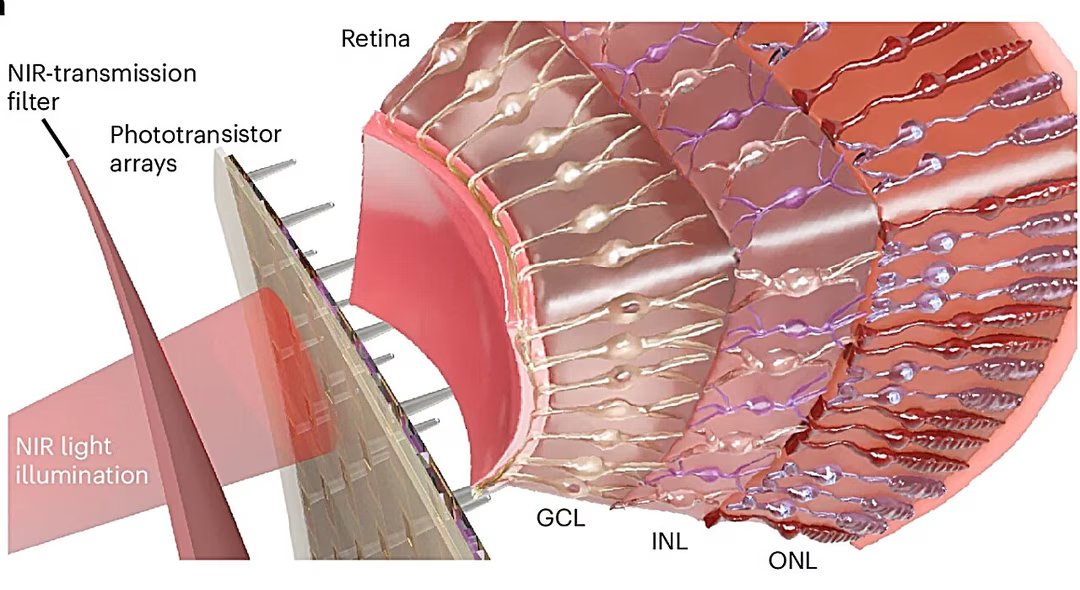 this artificial retina